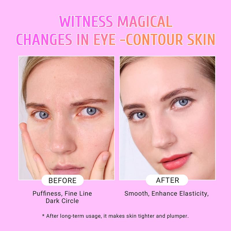 PEAUAMIE Under Eye Patches Gold and Hyaluronic Acid for puffy eyes,Rose Eye