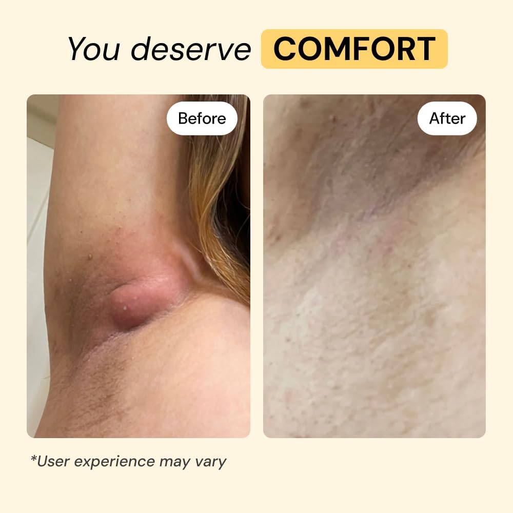 MyMagicHealer Universal Flare Care ‰ÛÒ Multi-Purpose Solution