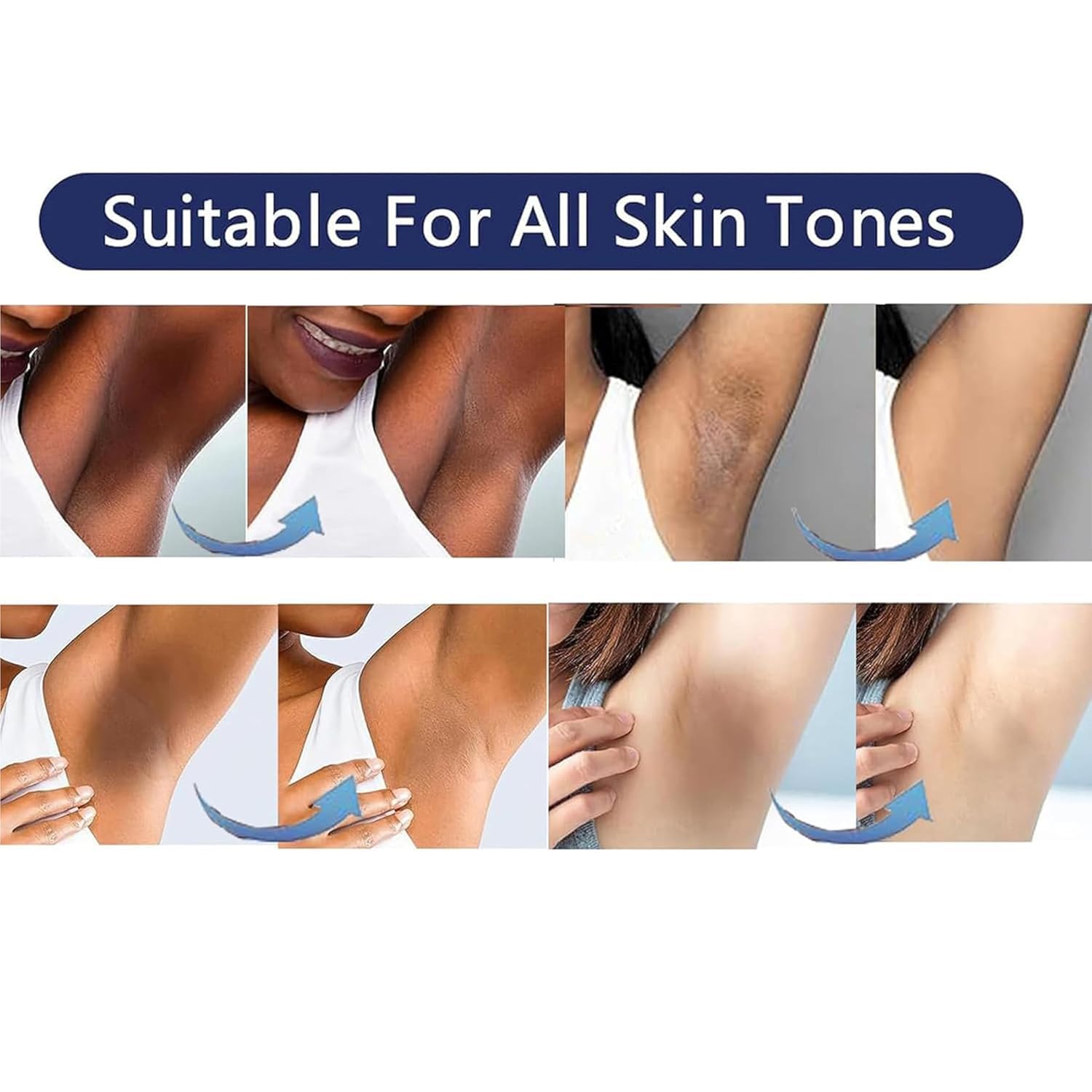 Skin Bleaching Cream Skin Lightening for Body Intimate Areas, Private Parts