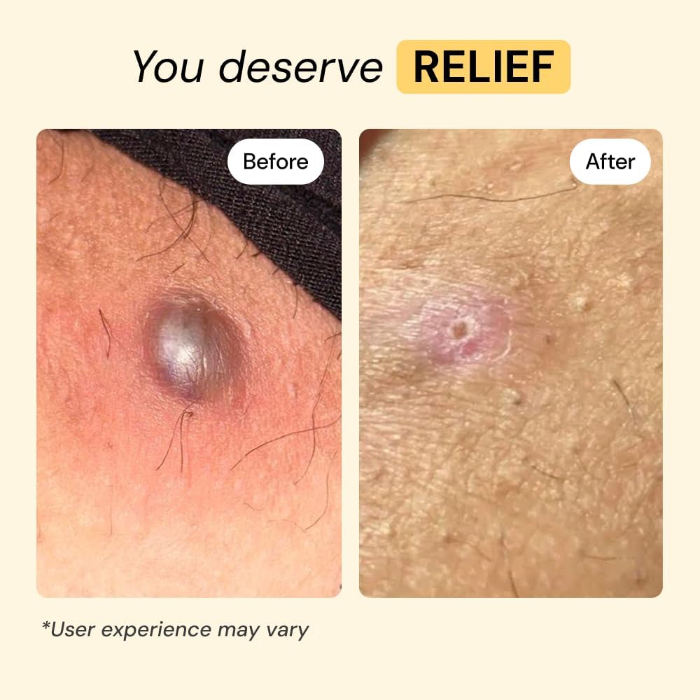 MyMagicHealer Universal Flare Care ‰ÛÒ Multi-Purpose Solution