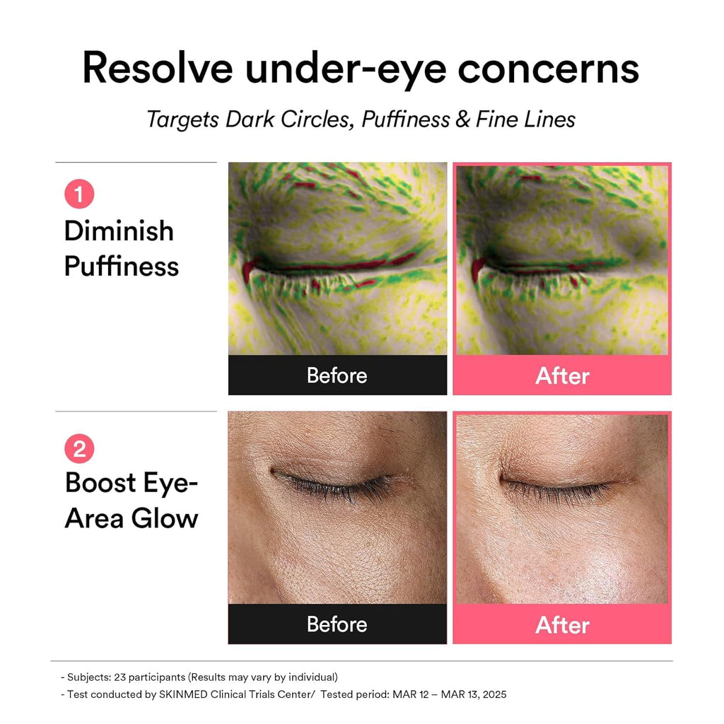 Abib PDRN Retinal Eye Patches for Rejuvenating & Puffy Eyes with Glow Jelly