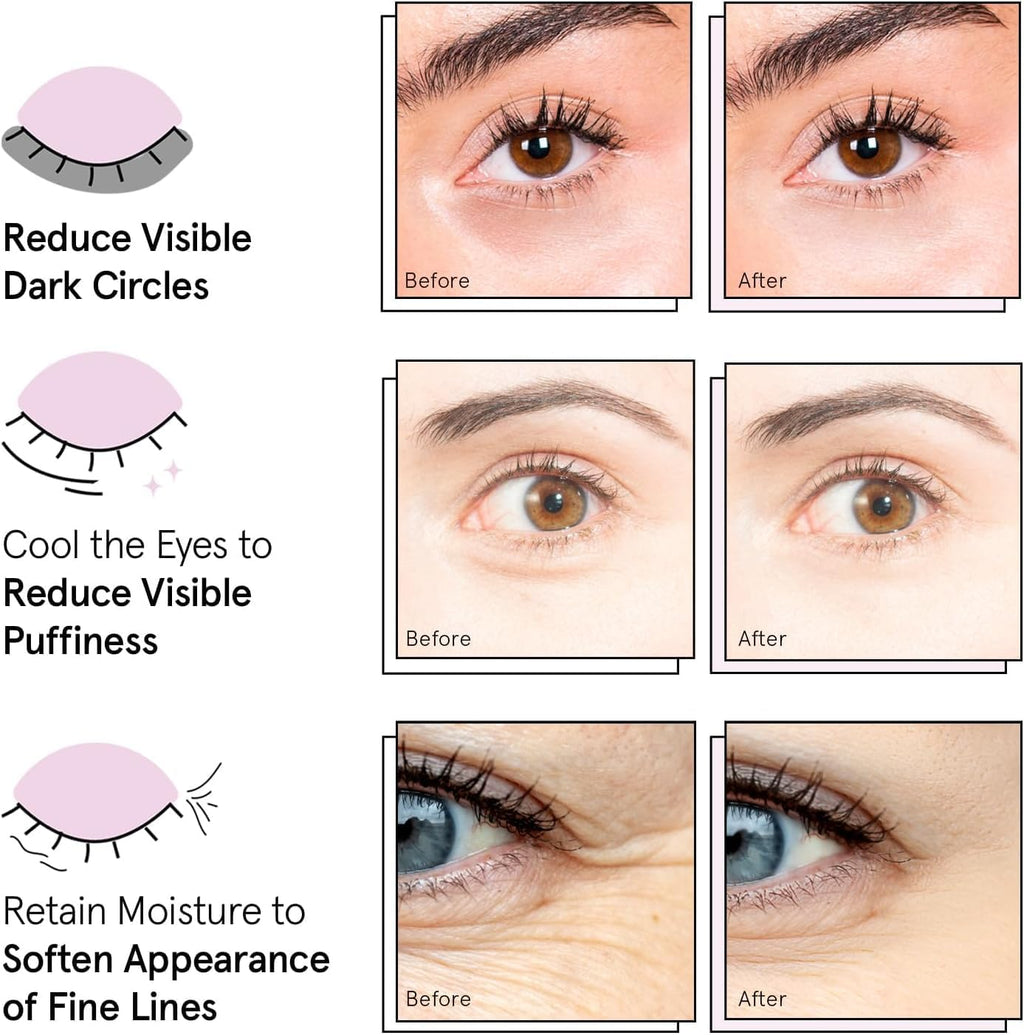 grace & stella Award Winning Under Eye Mask - Reduce Dark Circles, Puffy