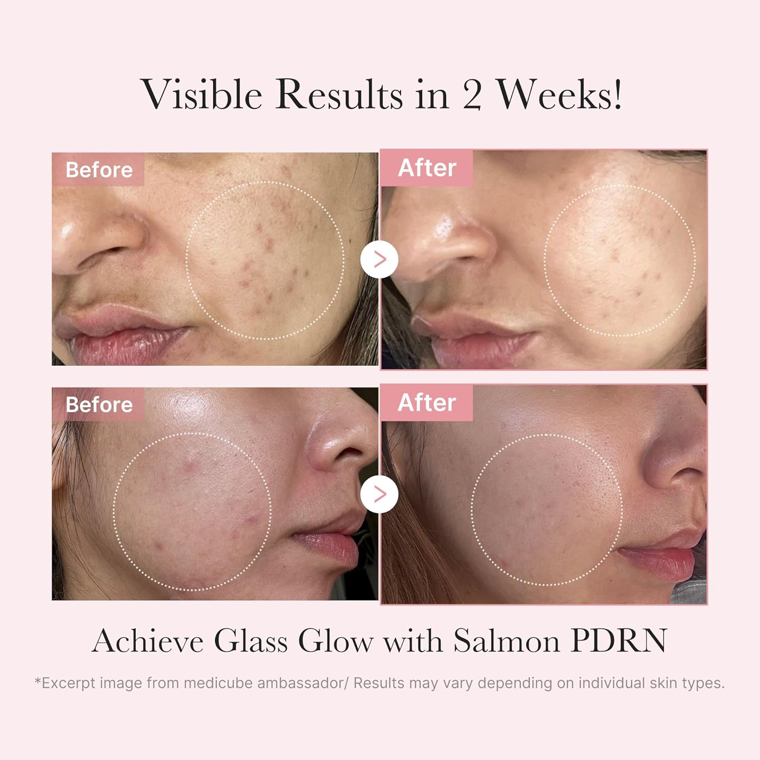 medicube Salmon DNA PDRN Trial Kit