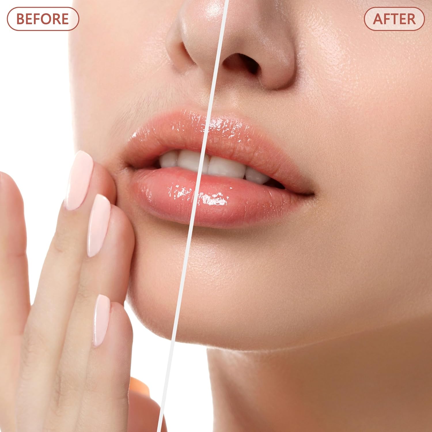 Facial Hair Remover for Women - as Seen on TV Painless Face Shaver - Electric
