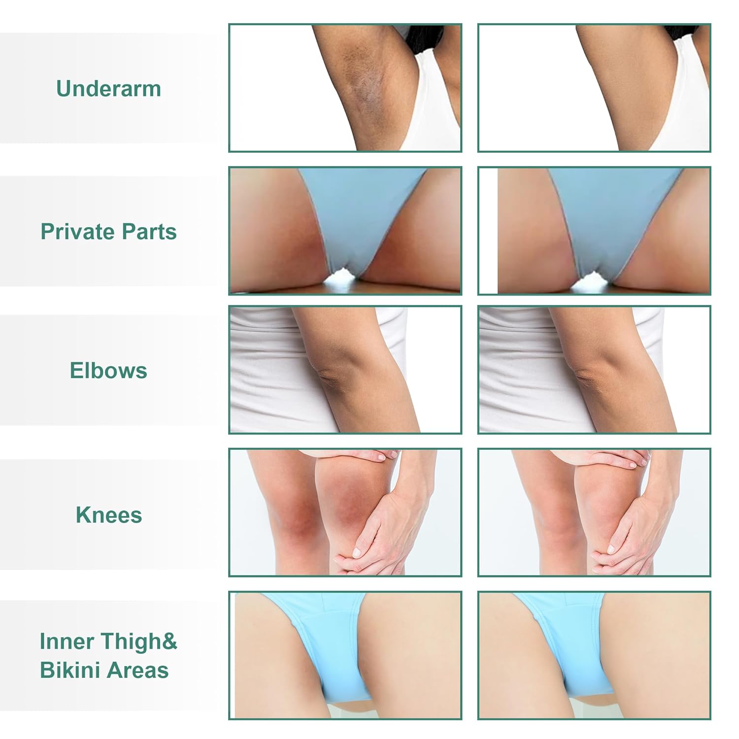 Skin Bleaching Cream Skin Lightening for Body Intimate Areas, Private Parts