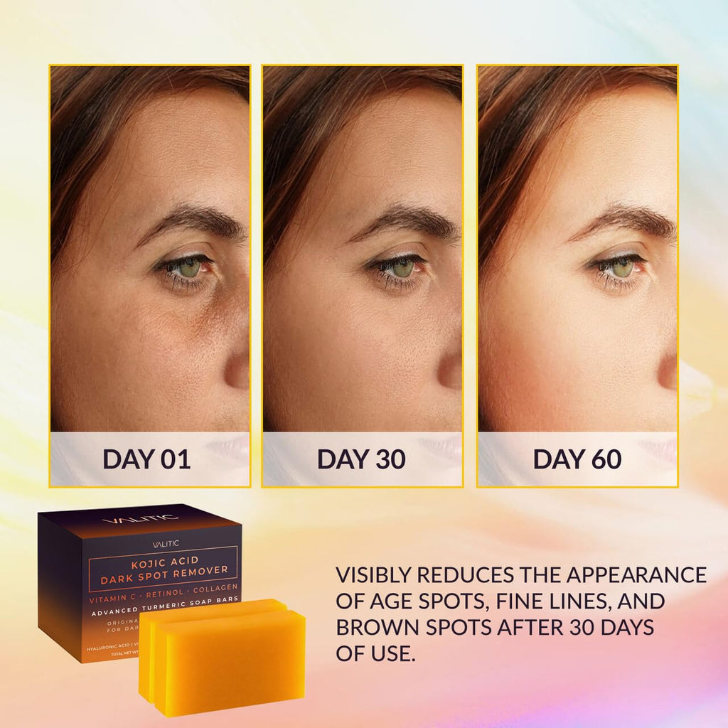 VALITIC Kojic Acid Dark Spot Remover Soap Bars with Vitamin C, Retinol