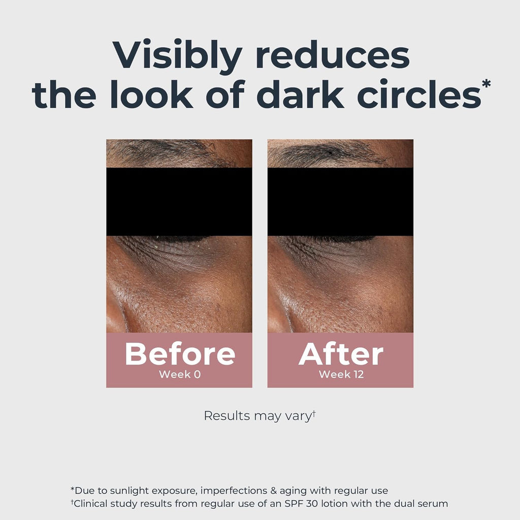Eucerin Radiant Tone Eye Cream Dark Circle Corrector, Eye Brightening Cream