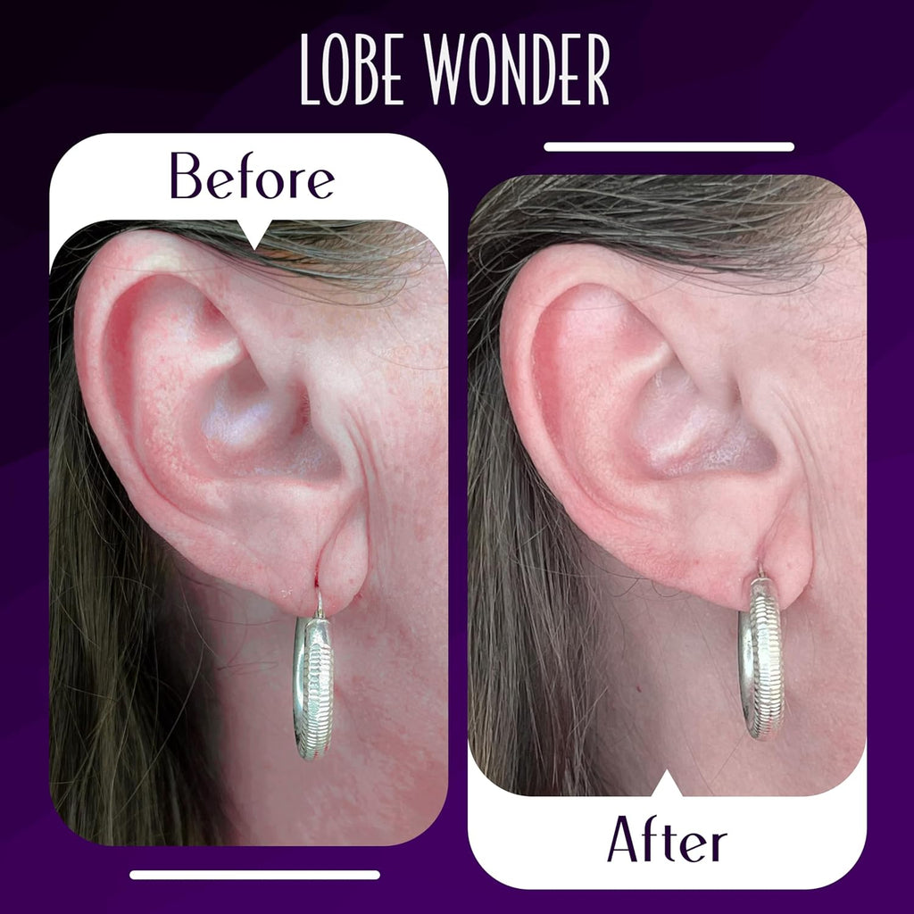Lobe Wonder - The ORIGINAL Ear Lobe Support Patch for Pierced Ears