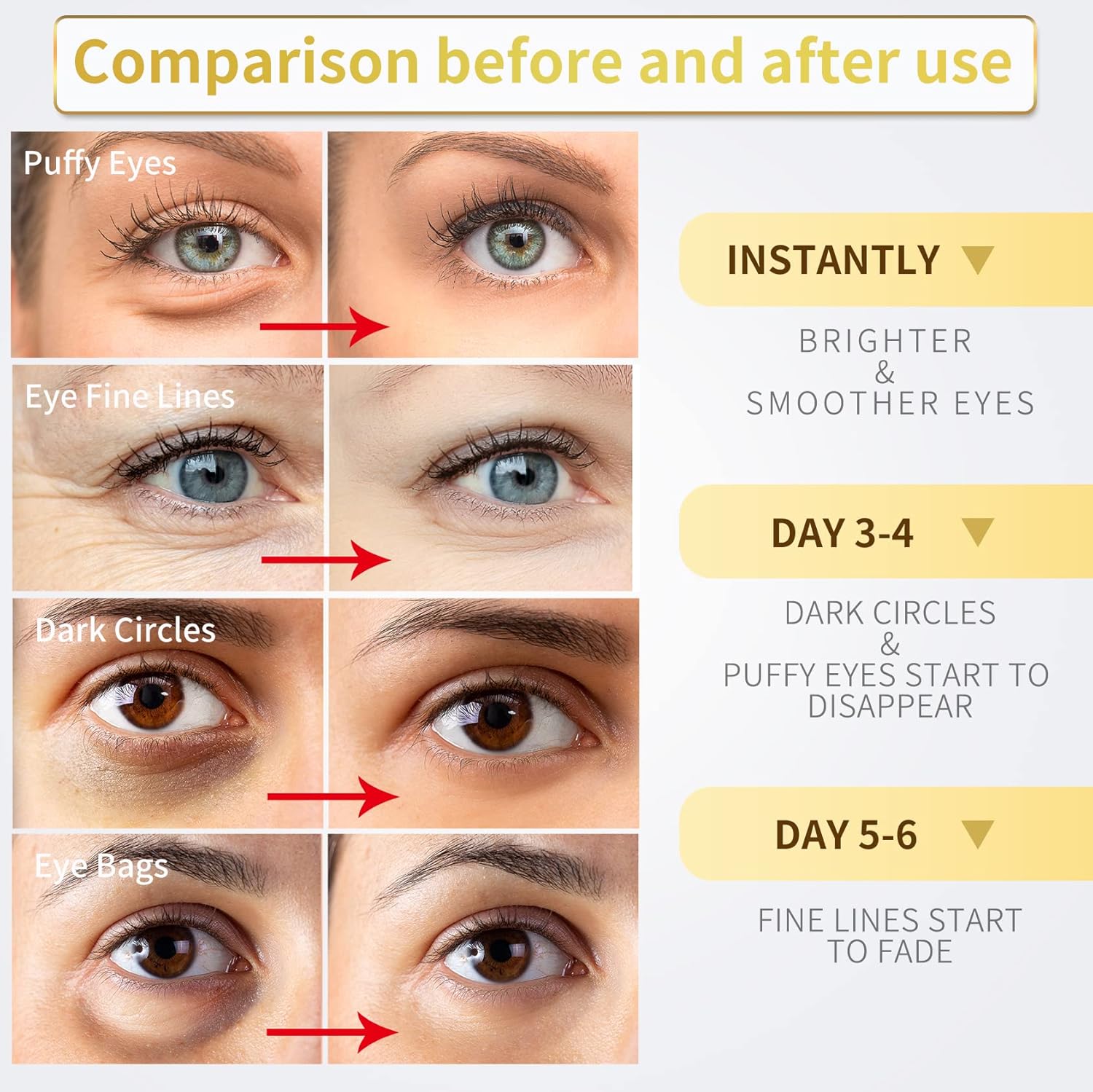 NAZANO 24K Gold Under Eye Patches - 60 Pack for Puffy Eyes, Dark Circles