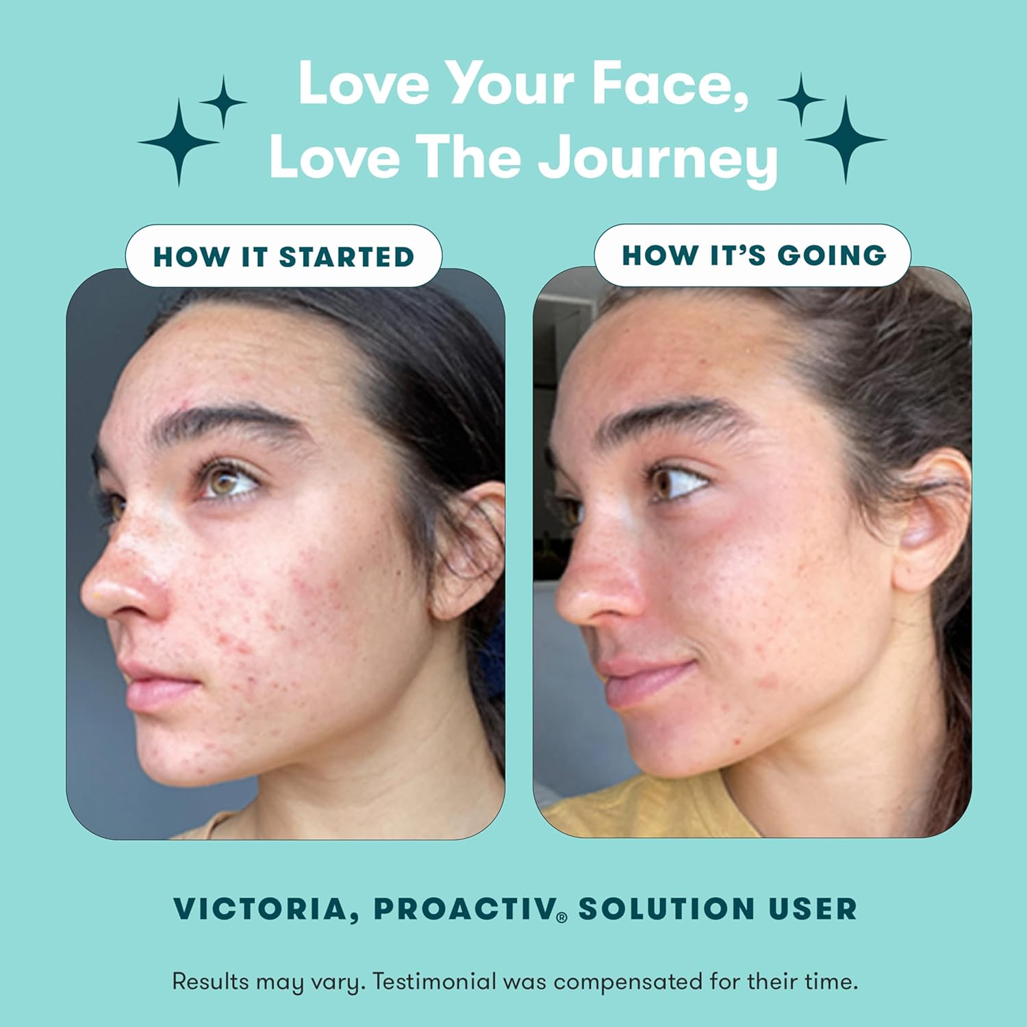 Proactiv 3 Step Acne Treatment - Benzoyl Peroxide Face Wash, Repairing Acne