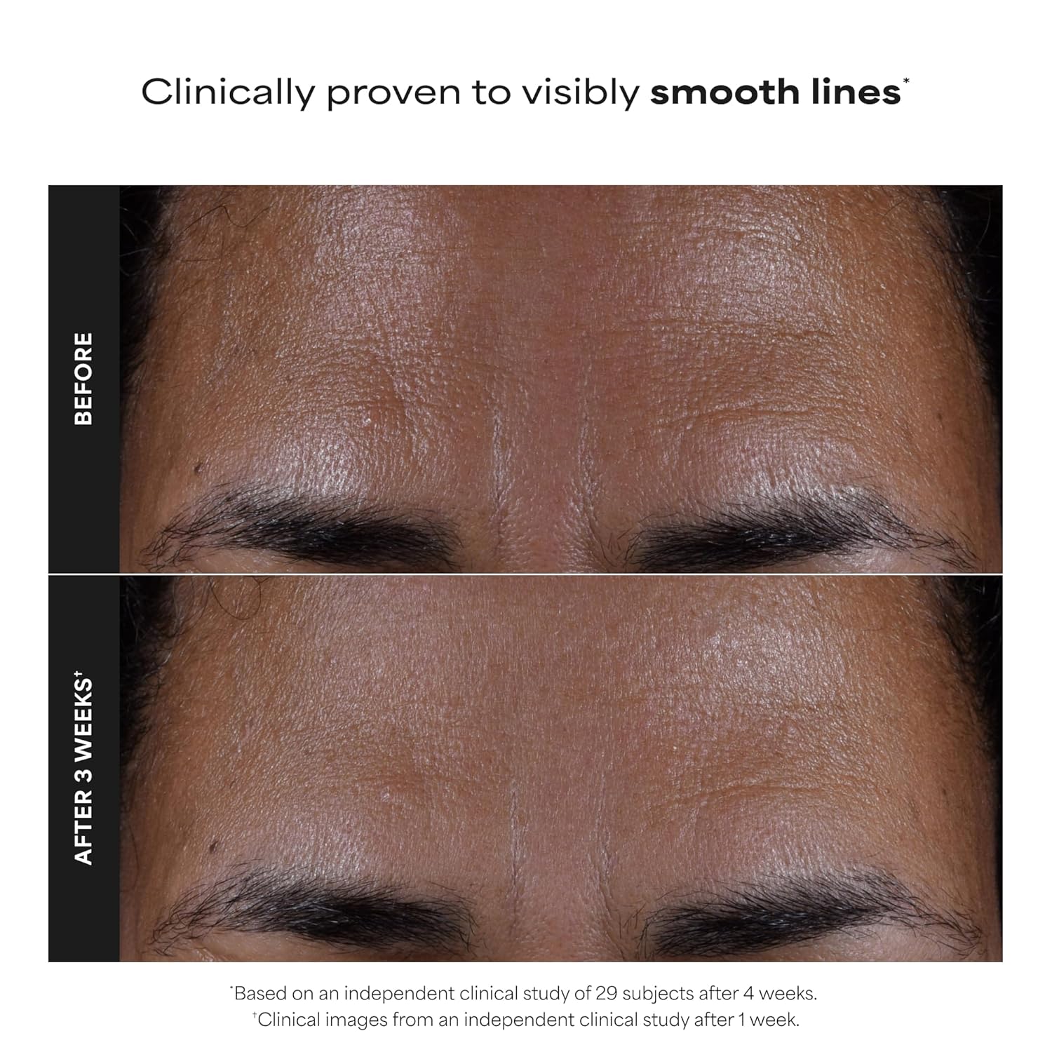 Paula's Choice SKIN PERFECTING 2% BHA Liquid Exfoliant with Salicylic Acid